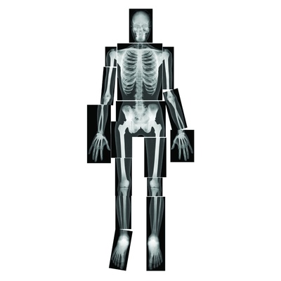 Human X-Rays Black/White Set